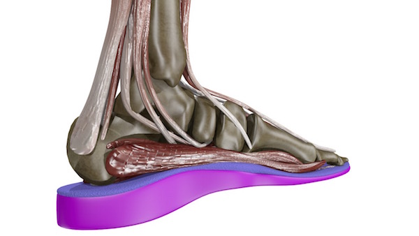 Sport Orthotic Model