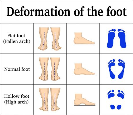 Us orthotic center